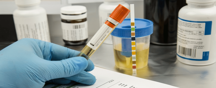 Drug test for workers comp