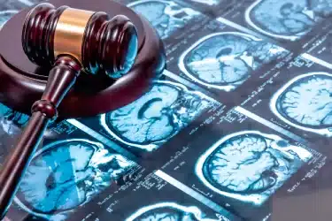 How much time does my lawyer have to file a claim for a brain injury?