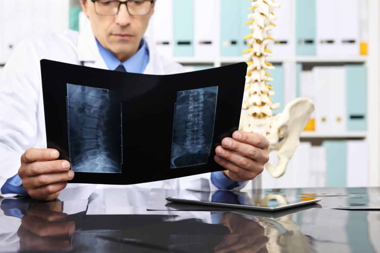 WHAT IS THE AVERAGE SETTLEMENT FOR A SERIOUS LOWER BACK PAIN IN A CAR ACCIDENT AFTER SURGERY